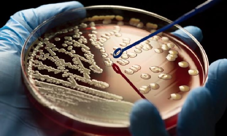 Scientists Hail New Antibiotic that can Kill Drug-Resistant Bacteria