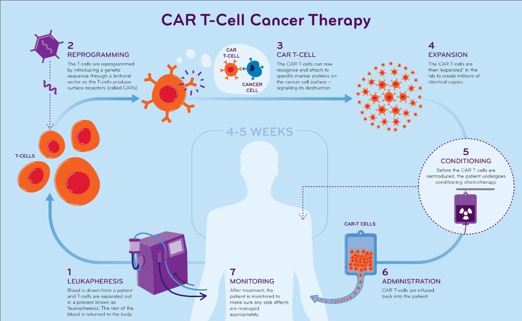 India's First patient Declared 'Cancer-Free' Using indigenous CAR-T Cell Therapy