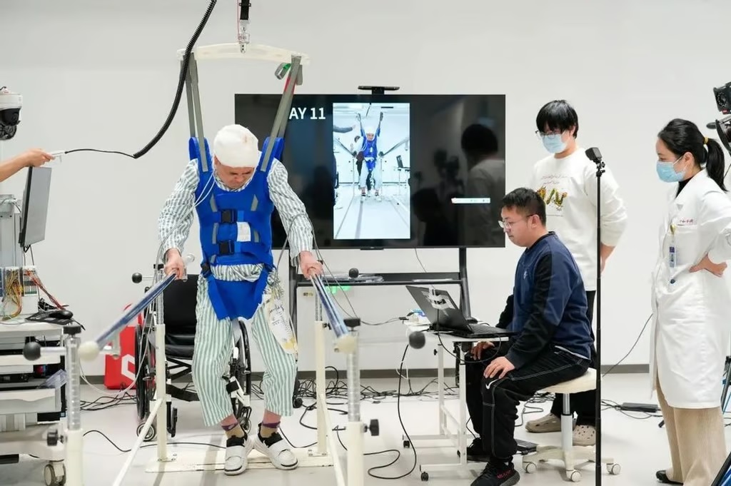 China’s Neurotechnology Breakthrough Restores Movement in Paralysed Patients, Challenging Elon Musk’s Neuralink